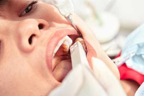 What is dental therapy?